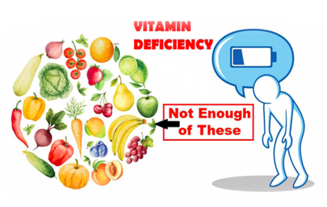 Deficiency on sale