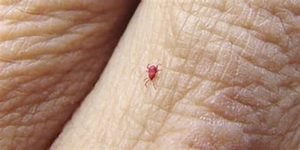 A picture of a small chigger, a tiny red bug.