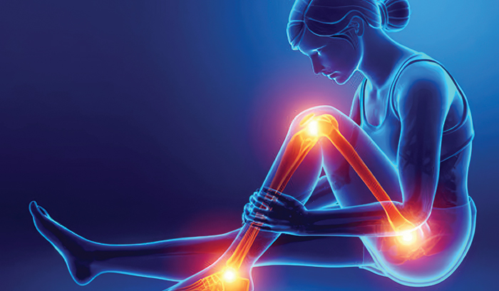 A diagram showing an inflamed left leg speaking about arthritis